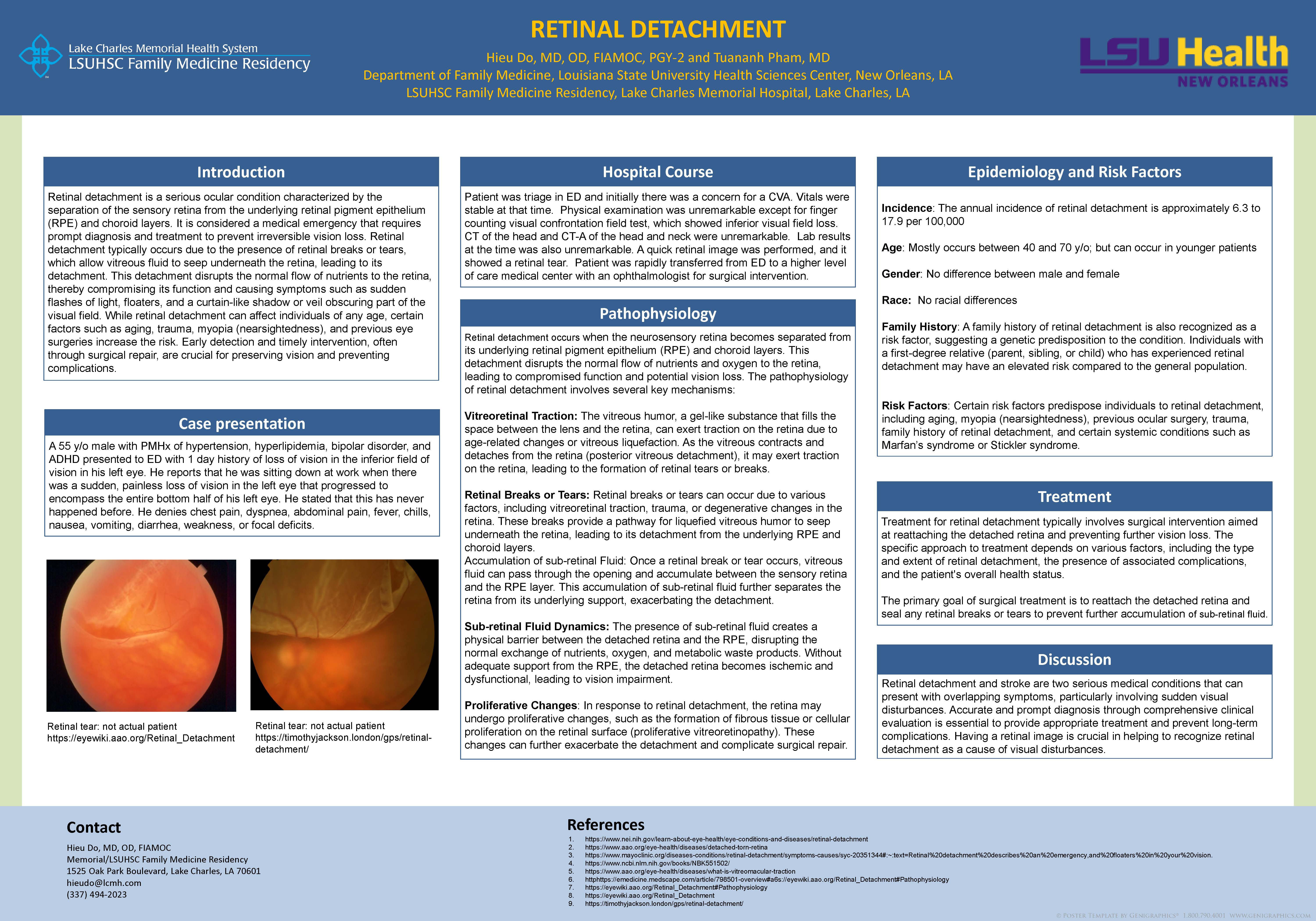 Hieu DO Retinal Detachment